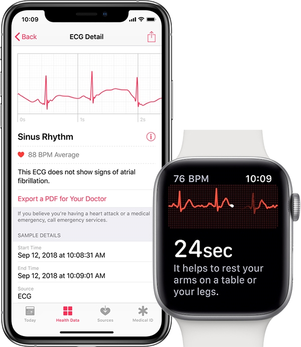 watchOS 5.1.2上线：ECG心电图功能来了