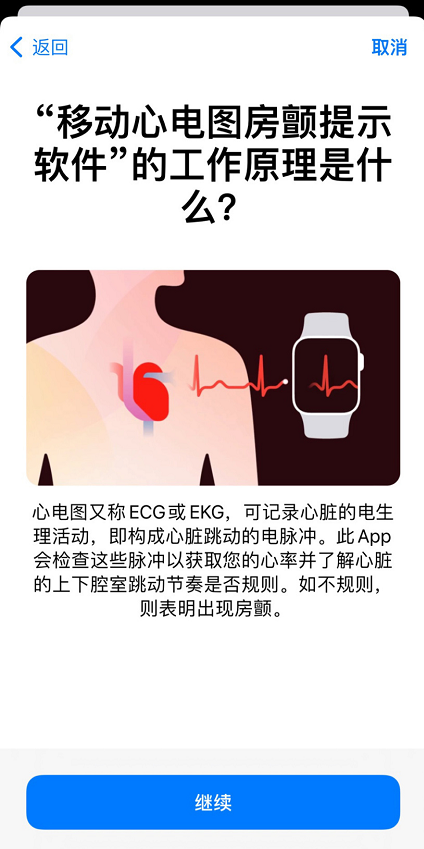 applewatch心电图怎么用?苹果手表国行心电图开启教程